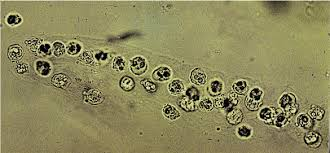 <p>Often look the cells are stuck to the outside.</p>