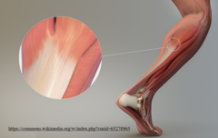 <p>tendons</p>