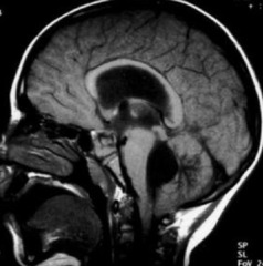 <p>Blockage of what would cause this?</p>