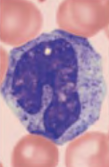 <p>What blood cell is this?</p>