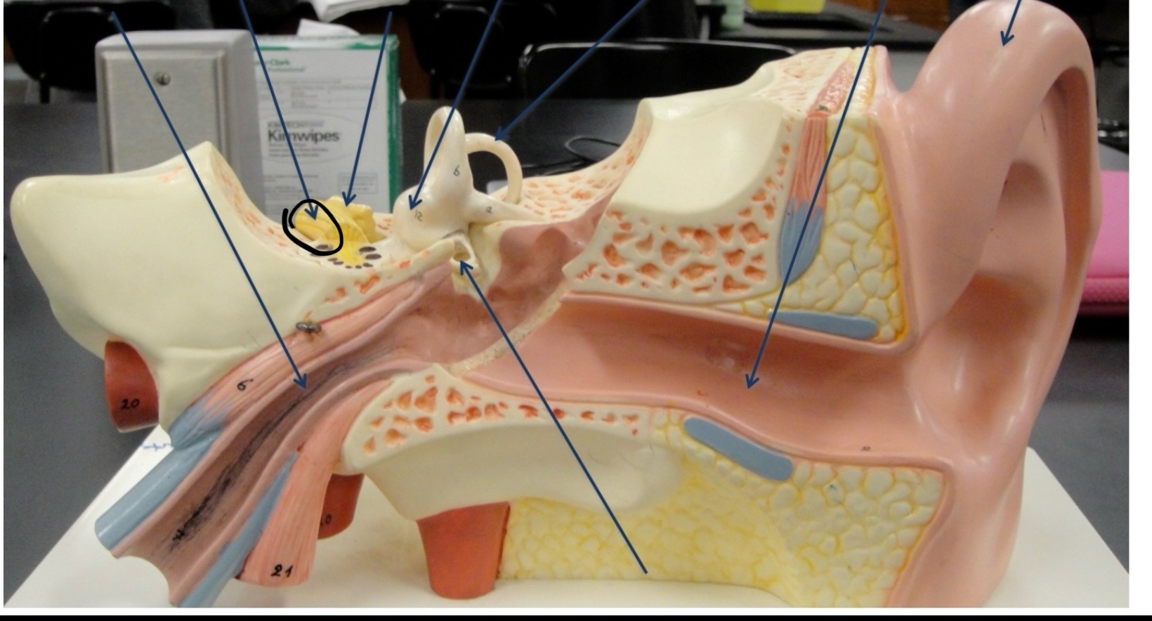 <p>Identify the circled area?</p>