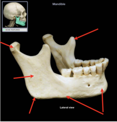 <p>What is the top right arrow pointing to?</p>
