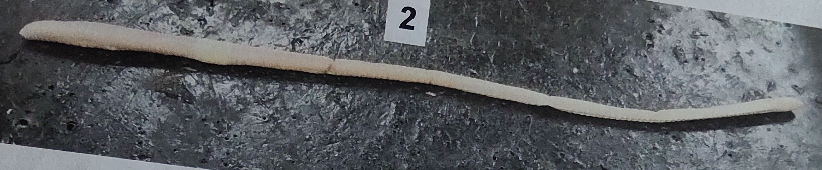 <p>What class are earthworms in </p>