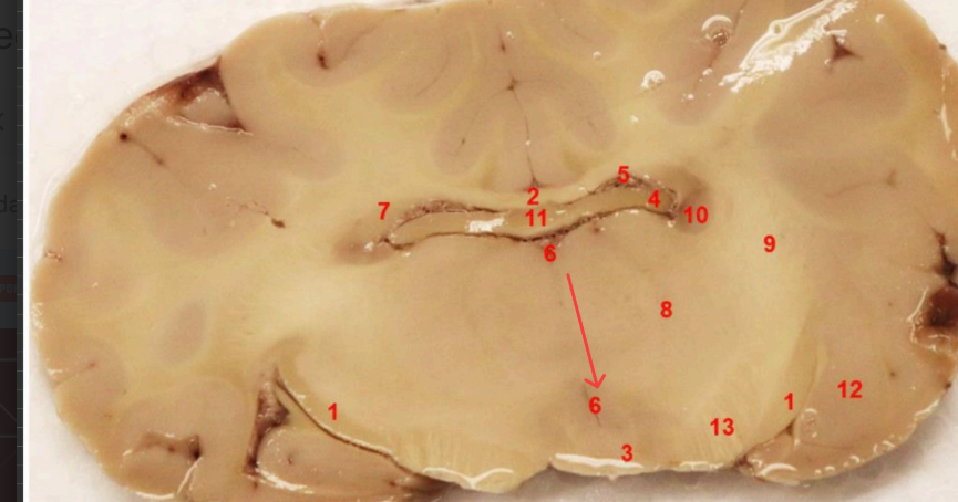 <p>what ventricle is this </p>