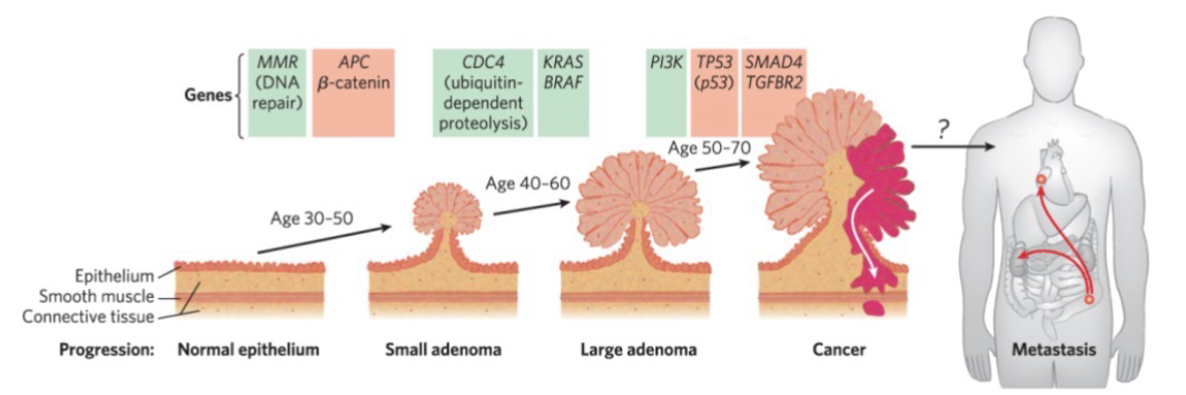 <p>Tumor progression is the conversion of a normal somatic cell into a cancerous tumor cell</p><p>The progression from a normal cell to a malignant tumor requires an accumulation of <strong>mutations</strong></p><ul><li><p>On average ~6-12 mutations in <strong>oncogenes</strong> & <strong>tumor suppressor genes</strong></p></li><li><p>No single mutation by itself is sufficient to generate a cancer cell</p></li><li><p>Once a mutation is established within a genome of a cell, it is permanent, and daughter cells can develop further mutations</p></li></ul><p>Colorectal cancer has several recognizable stages; At least 7 genetic “hits” to become a <strong>carcinoma</strong> (Malignant tumor)</p>