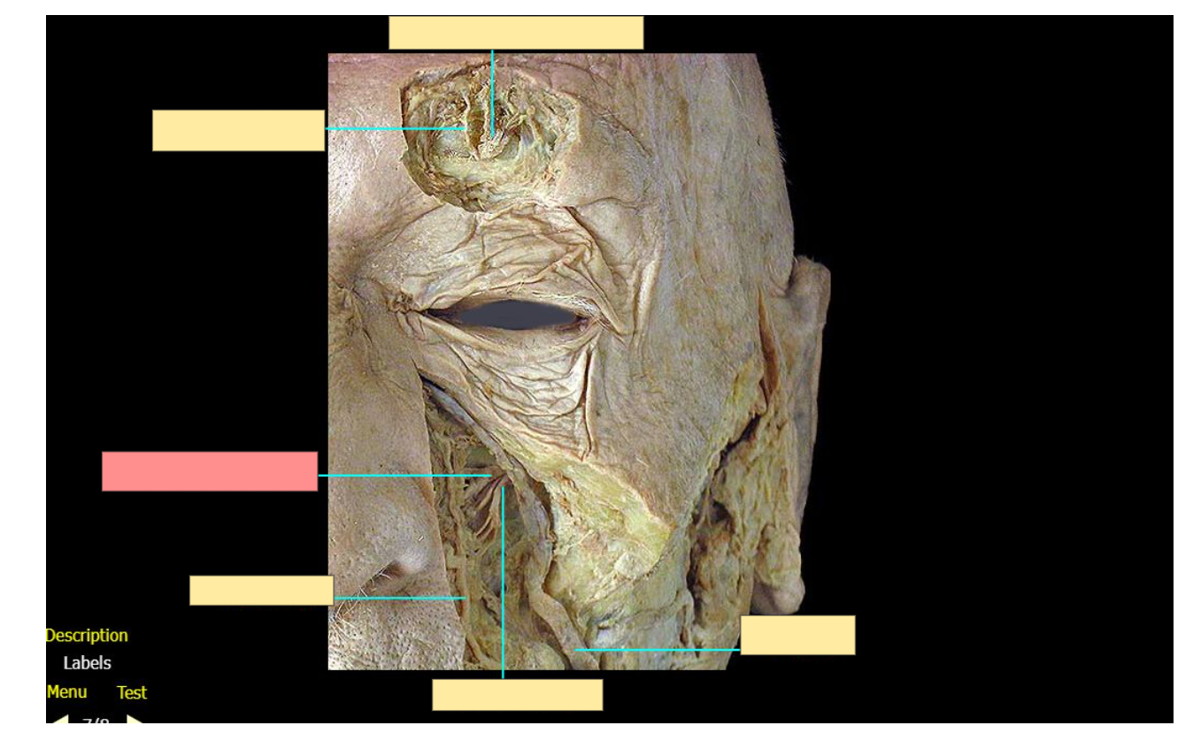 <p>Name the structure</p>