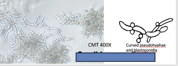 <p>ID the type of yeast </p>