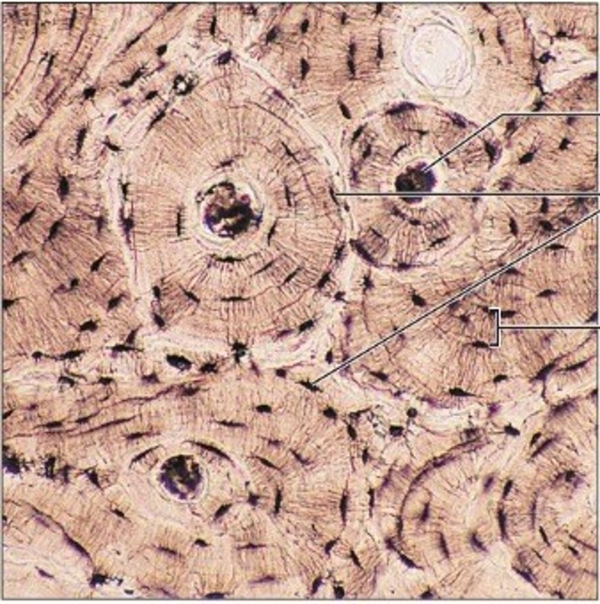 <p>bone is what type of tissue?</p>