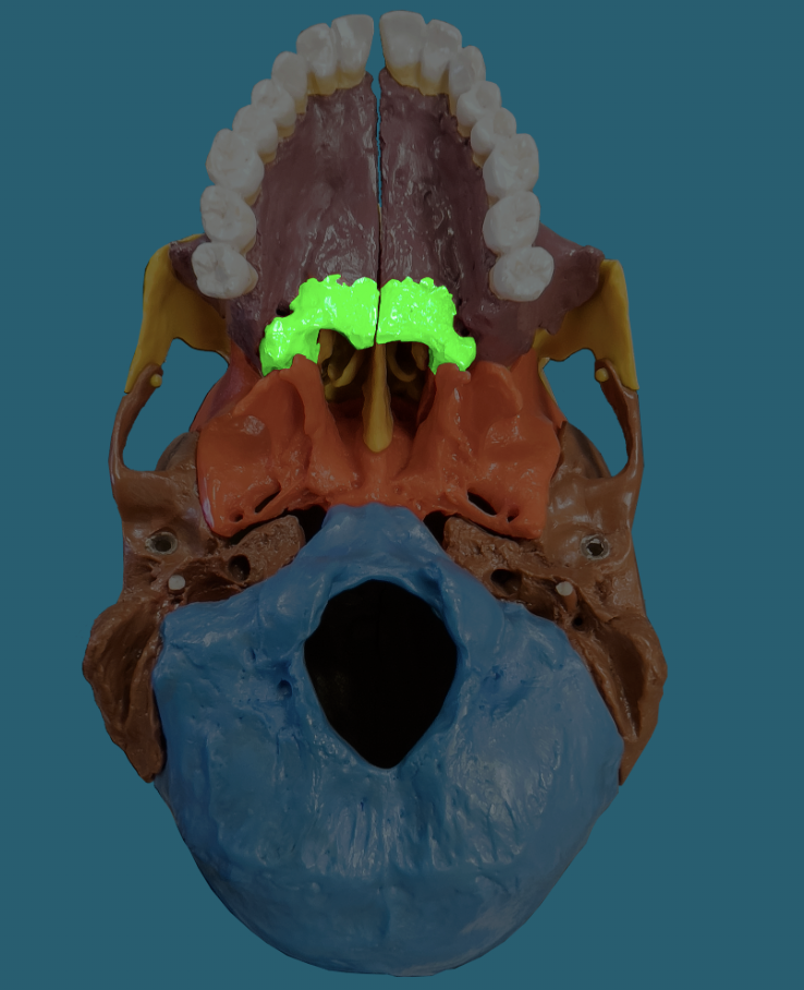 term image