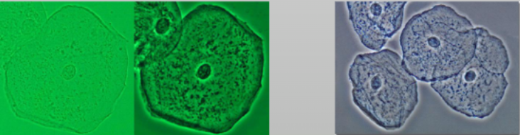 <p><span>Transparent objects (like cells) are treated with chemical stains to</span><br><span>distinguish different parts</span></p><ul><li><p>Chemical: a dye or reagent used to color microscopic structures, cells, or tissues to increase visual contrast and highlight specific components</p></li><li><p>Fluorescent: specialized chemical dyes or tagged molecules that bind to specific cellular components or macromolecules and emit visible light when excited by a specific wavelength of light</p></li></ul><p></p>