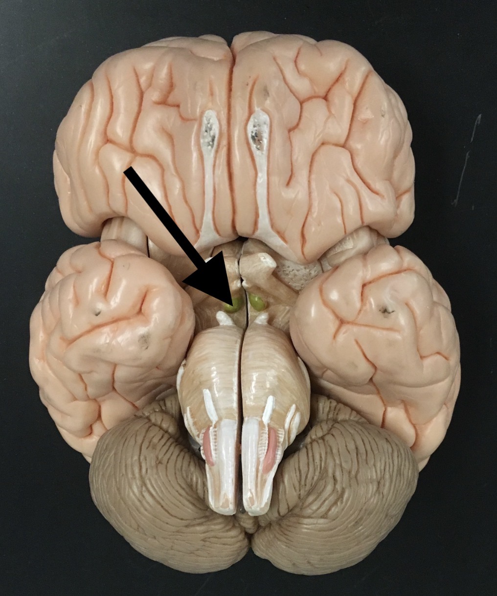 <p>What is the arrow pointing to?</p>