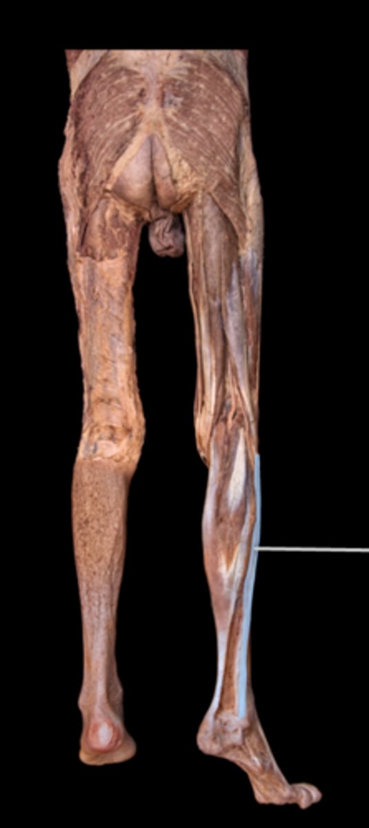 <p>What muscle is this?</p>