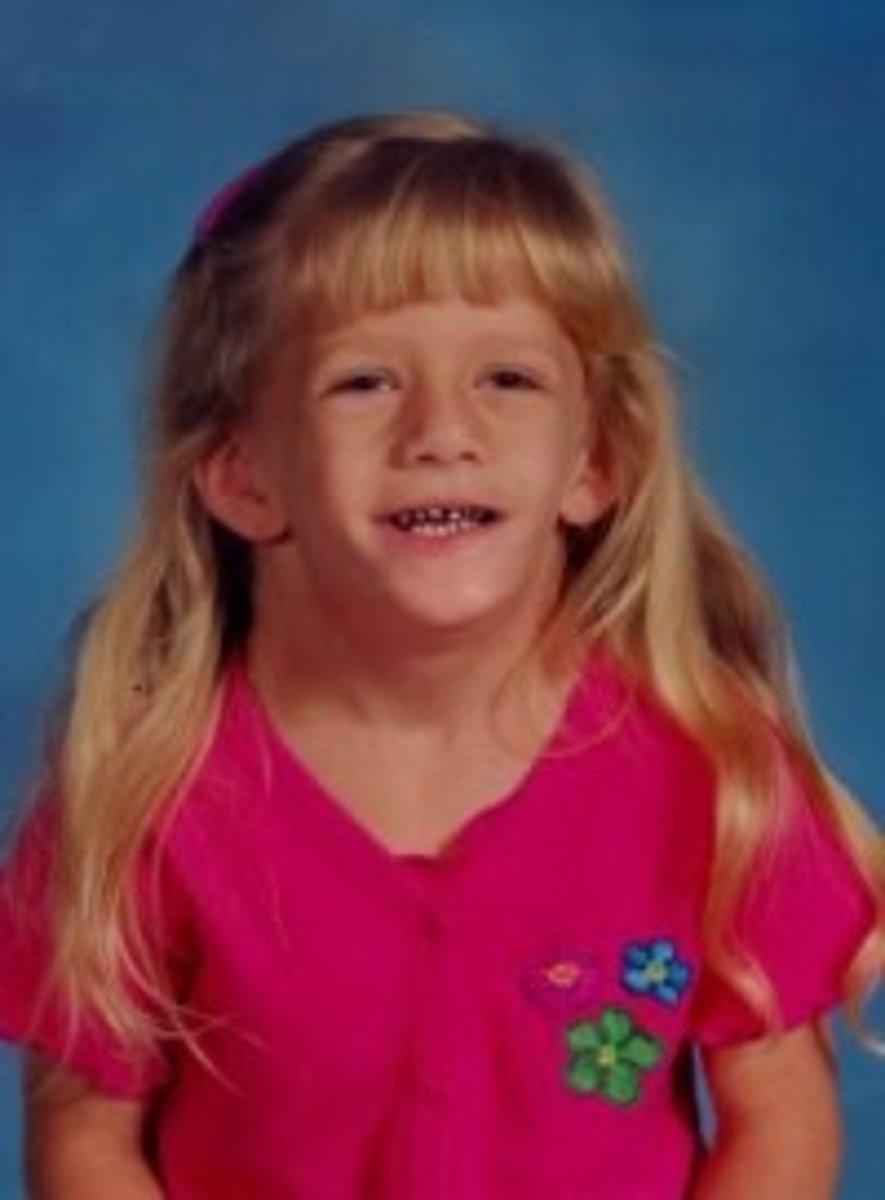 <p>Turner Syndrome</p>