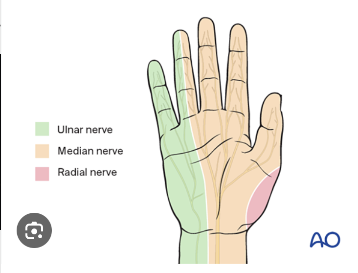 <p>Median Nerve Palsy</p>