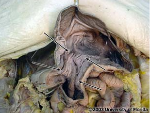 <p>what structure is pictured here?</p>