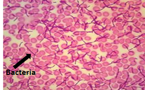 <p>Bacteremia/septicemia </p>