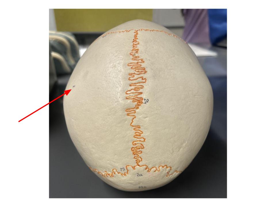 <p>scalp</p>