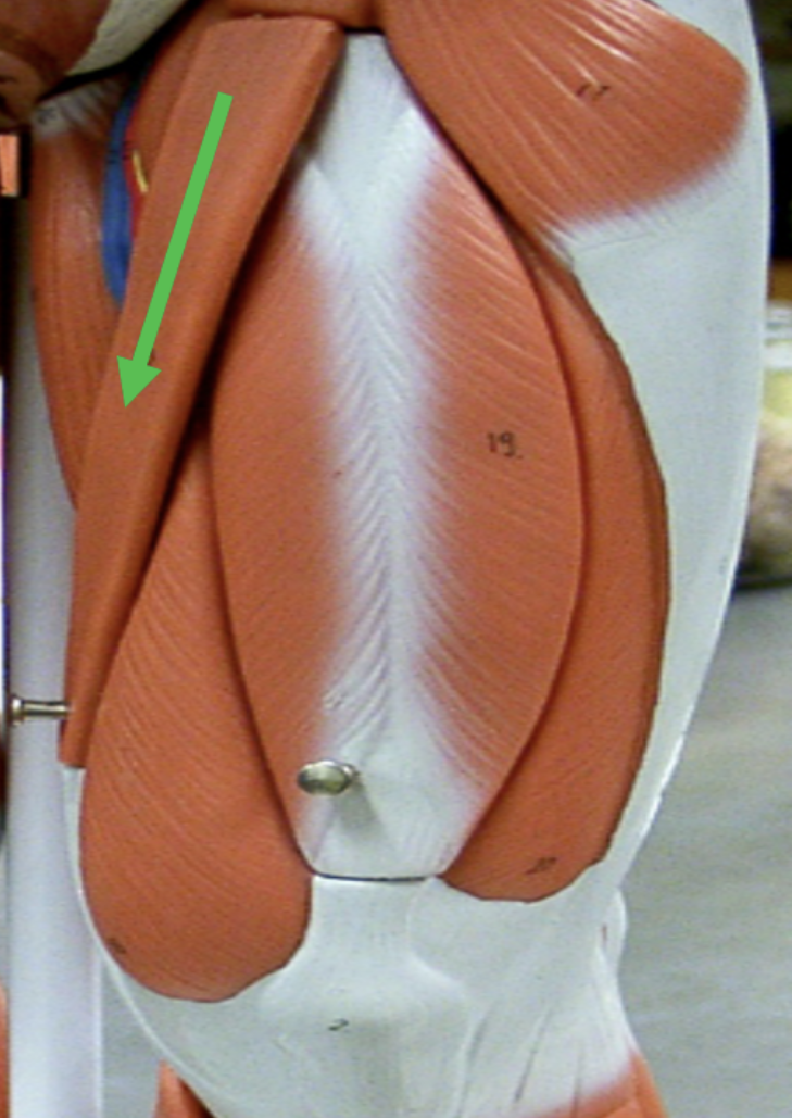 <p>Identify the muscle indicated by the pointer.</p>