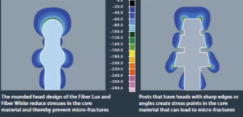 <p>Using computer analysis and imaging, areas of stress concentrations can be predicted. This color indicates areas of greatest stress</p>