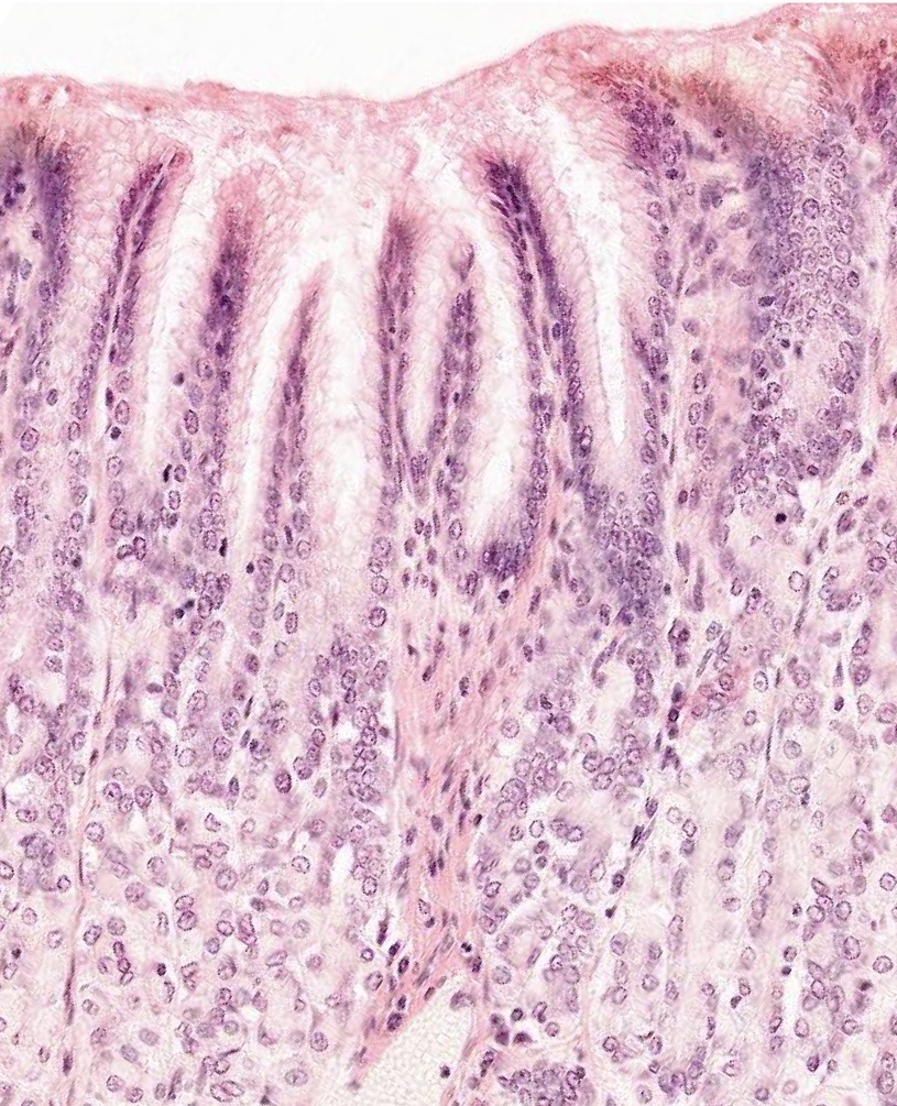 <p>What area of the stomach is this?</p>