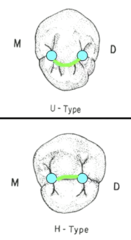 <p>straight</p>