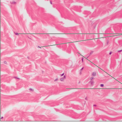 <p>name the tissue: primarily irregularly arranged collagen fibers; some elastic fibers; major cell type is the fibroblast</p>