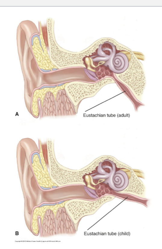 <p>A child’s eustachian tube is shorter and flatter which makes it hard for any infectious fluid to drain </p>