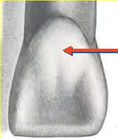 <p>What is the name of the indicated structure? </p>