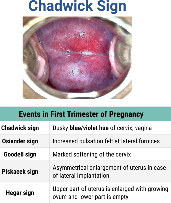 <p><strong>Bluish discoloration of the vagina and cervix</strong> caused by an <strong>increase in pelvic vasculature. </strong>Yes it is common</p>