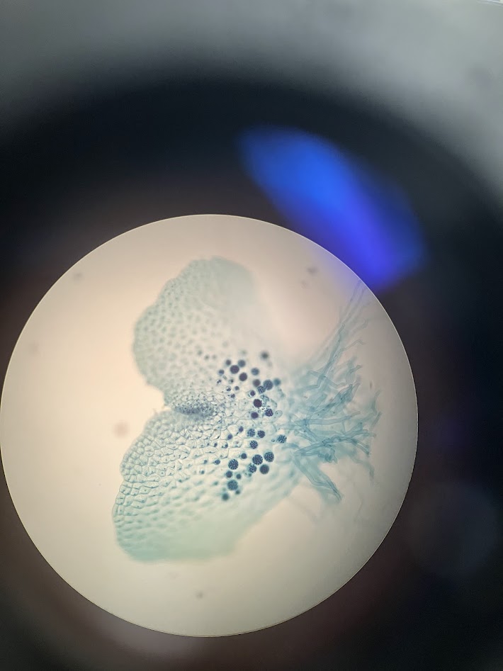 <ol><li><p>what is the phylum?</p></li><li><p>what is the structure?</p></li><li><p>what are the dark dots?</p></li></ol><p></p>