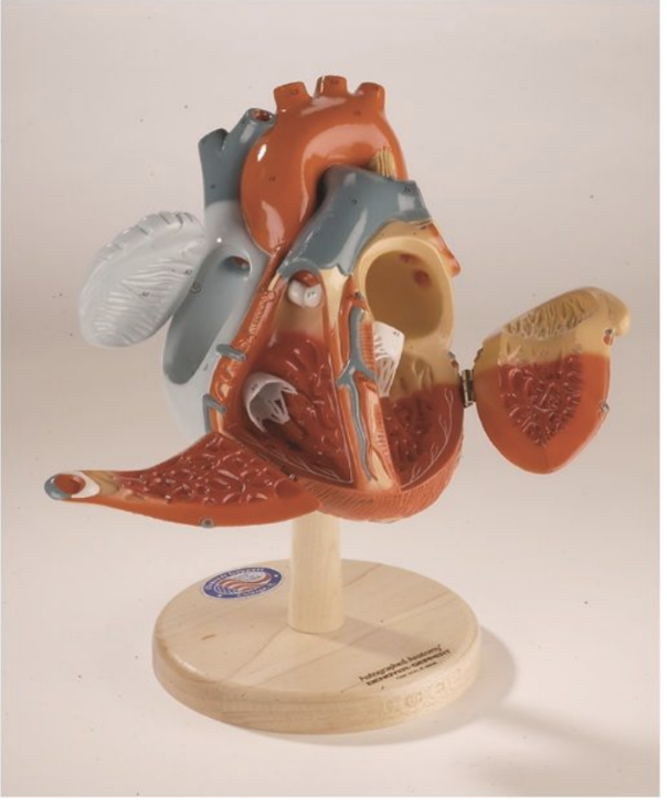 <p>Brachiocephalic Trunk</p>