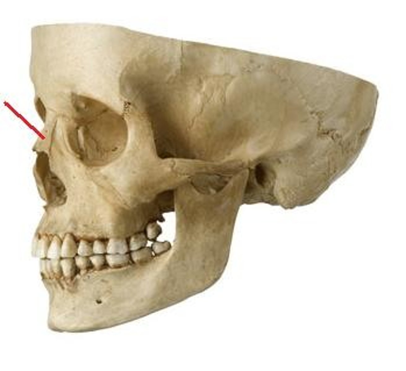 <p>ID bone at arrow</p>