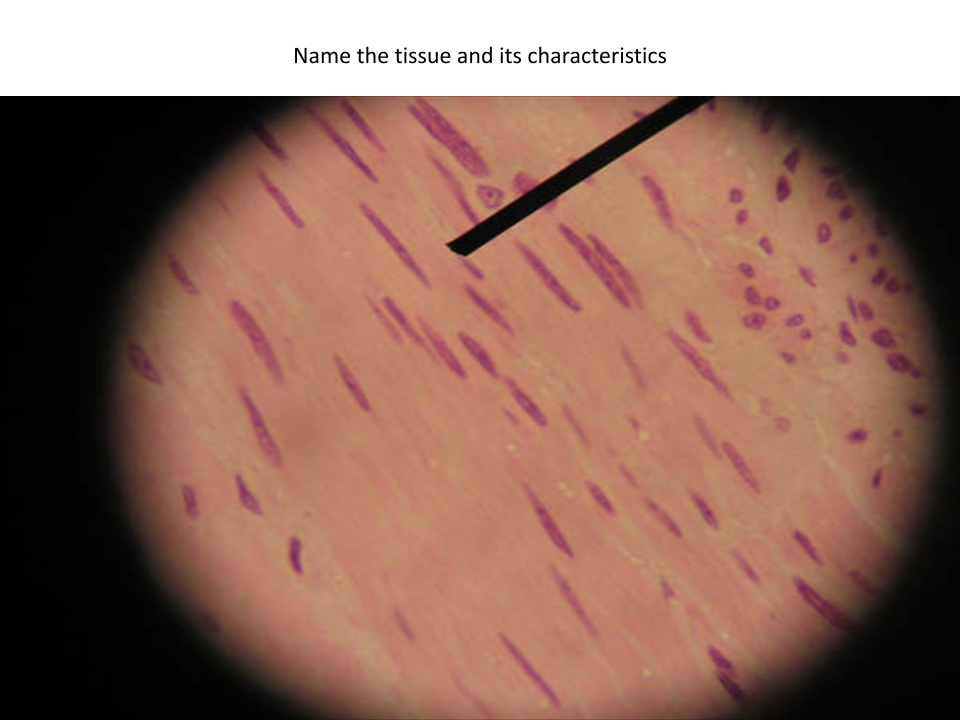 <p>Name of tissue?</p>