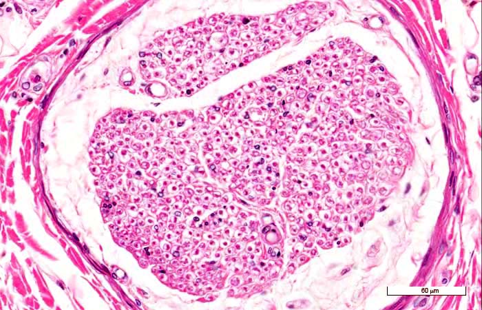 <p>Identifica la plaquita</p>