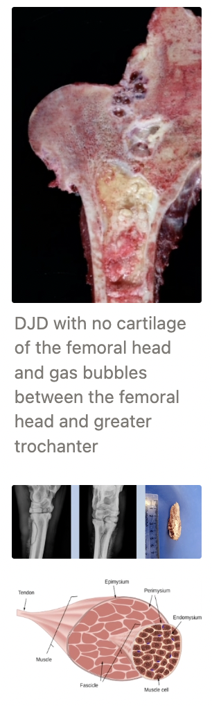 <ol><li><p><strong>Degenerative joint disease</strong></p><ul><li><p>2˚ to congenital dysplasia (OCD, deformation, trauma)</p></li></ul></li><li><p><strong>Osseous sequestration</strong></p><ul><li><p>Bone fragment loses blood supply after trauma/infection → Necrotic fragment acts as a foreign body → Abscessation and periosteal reaction</p></li></ul></li><li><p><strong>Ischaemic myopathy (aka. compartment syndrome)</strong></p><ul><li><p>Complication of prolonged recumbency (Downer Cow Syndrome) → Increased CK and AST</p></li></ul></li></ol><p></p>
