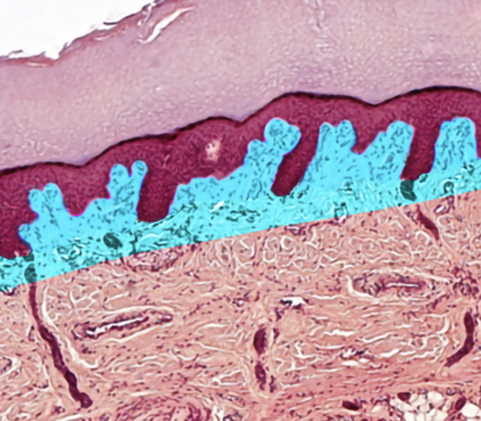 term image