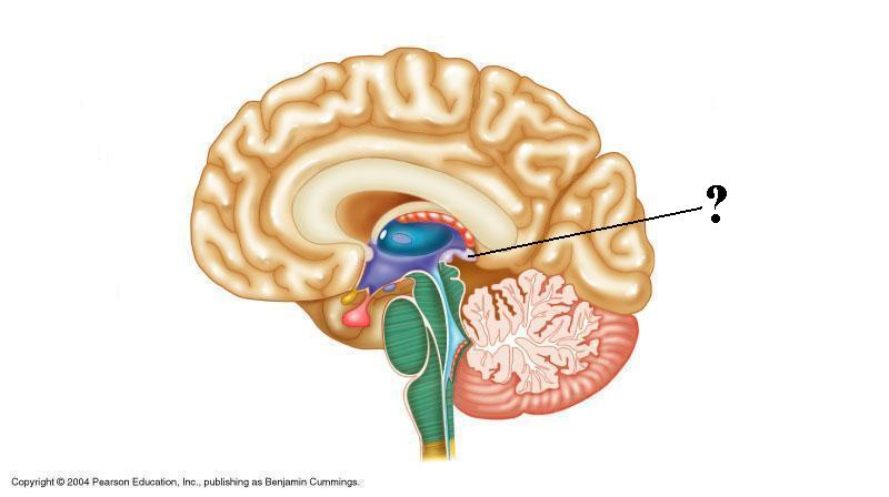 <p>Identify the indicated structure of the brain</p>