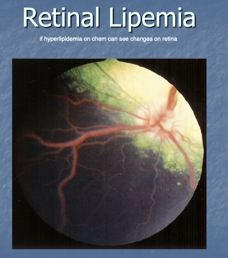 <p>hyperlipidemia </p>