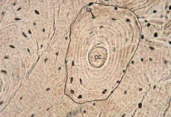 <p>structure; tissue type</p>