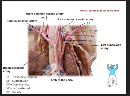 <p>Branches into 3 branches; most medial branch of the aortic arch</p>