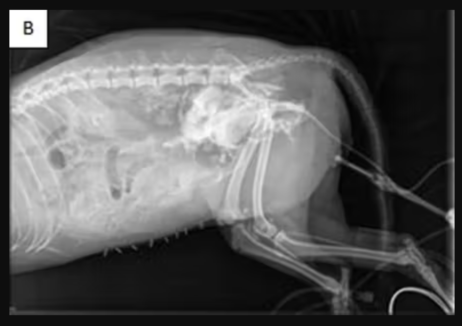 <p>Barnaby is presented following a road traffic accident. Physical examination reveals abdominal pain and the bladder cannot be palpated in the normal location.</p><p>Urinary bladder rupture is suspected.</p><p>A standard lateral abdominal radiograph is obtained. The bladder is not visible as a distinct structure — the cranial abdomen shows increased opacity with loss of serosal detail, but no definitive bladder outline is identifiable.</p><p>The clinician explains: "Bladder and adjacent soft tissues have similar X-ray attenuation — without contrast, the bladder wall blends into surrounding structures."</p><p>A positive contrast cystogram is performed: iodinated contrast is instilled via urinary catheter into the bladder.</p><p>Barnaby:</p><p></p><p><strong>Which explanation best accounts for why the standard radiograph could not confirm bladder rupture AND why the contrast study successfully demonstrates the injury?</strong></p><p>a. The standard radiograph failed because the bladder is too small to be visible radiographically — contrast expands the bladder to a size large enough to be detected. The contrast also stiffens the bladder wall, making it easier to identify its outline.</p><p>b. The standard radiograph failed because X-rays cannot penetrate the fluid-filled bladder — contrast absorbs X-rays differently from fluid, allowing the beam to pass through the bladder and reveal its contents and wall.</p><p>c. The standard radiograph failed because trauma causes inflammation that scatters X-rays unpredictably, preventing formation of a clear image. Contrast reduces scatter by providing a stable high-attenuation reference structure.</p><p>d. The standard radiograph could not visualize the bladder because the bladder wall and surrounding soft tissues have nearly identical X-ray attenuation — no contrast boundary exists between them. Iodinated contrast instilled into the bladder lumen has very high X-ray attenuation (due to iodine's high atomic number), creating a large attenuation difference between the lumen and adjacent structures, making the bladder outline and any rupture site clearly visible.</p>
