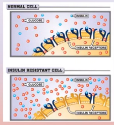 <p><span>If you are consuming too much sugar, the cells can stop recognizing insulin, this is known as:</span></p>