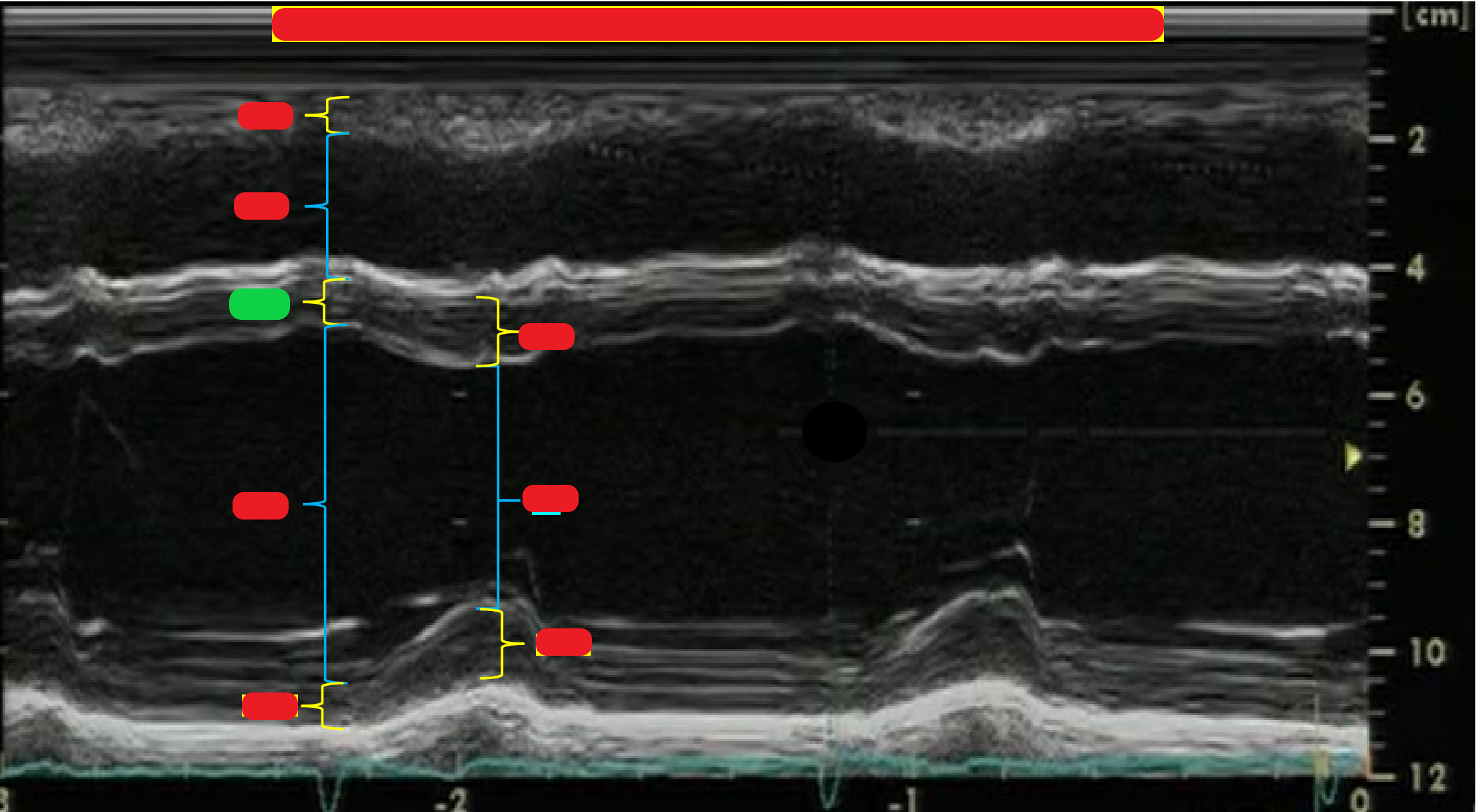 <p>What is highlighted in green?</p>