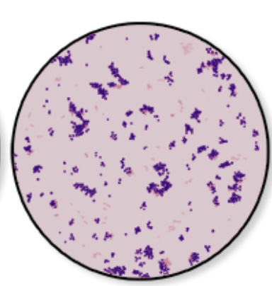 <p>Gram-Positive</p>