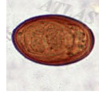 <p>Lancet&nbsp;Liver&nbsp;Fluke</p><p>Cattle,&nbsp;sheep,&nbsp;goats,&nbsp;pig,&nbsp;wild&nbsp;ungulates,&nbsp; rodents,&nbsp;rabbits,&nbsp;rarely&nbsp;humans</p>