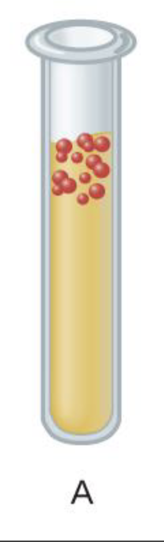 <ul><li><p>Bacteria classification based on oxygen needs </p></li><li><p>Needs oxygen to survive </p></li></ul><p></p>