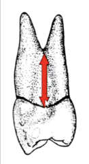 <p>thin connection between the main portions of the root structure</p>