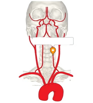 <p>Identify the structure pinned</p>