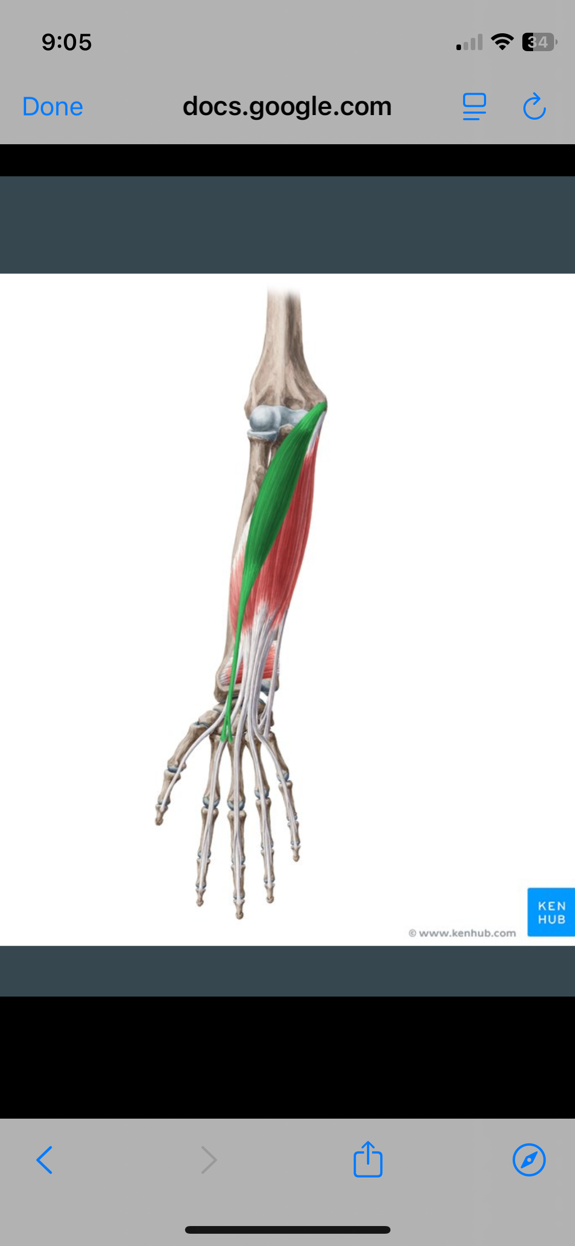 <p>Flexor Carpi Radialis </p>