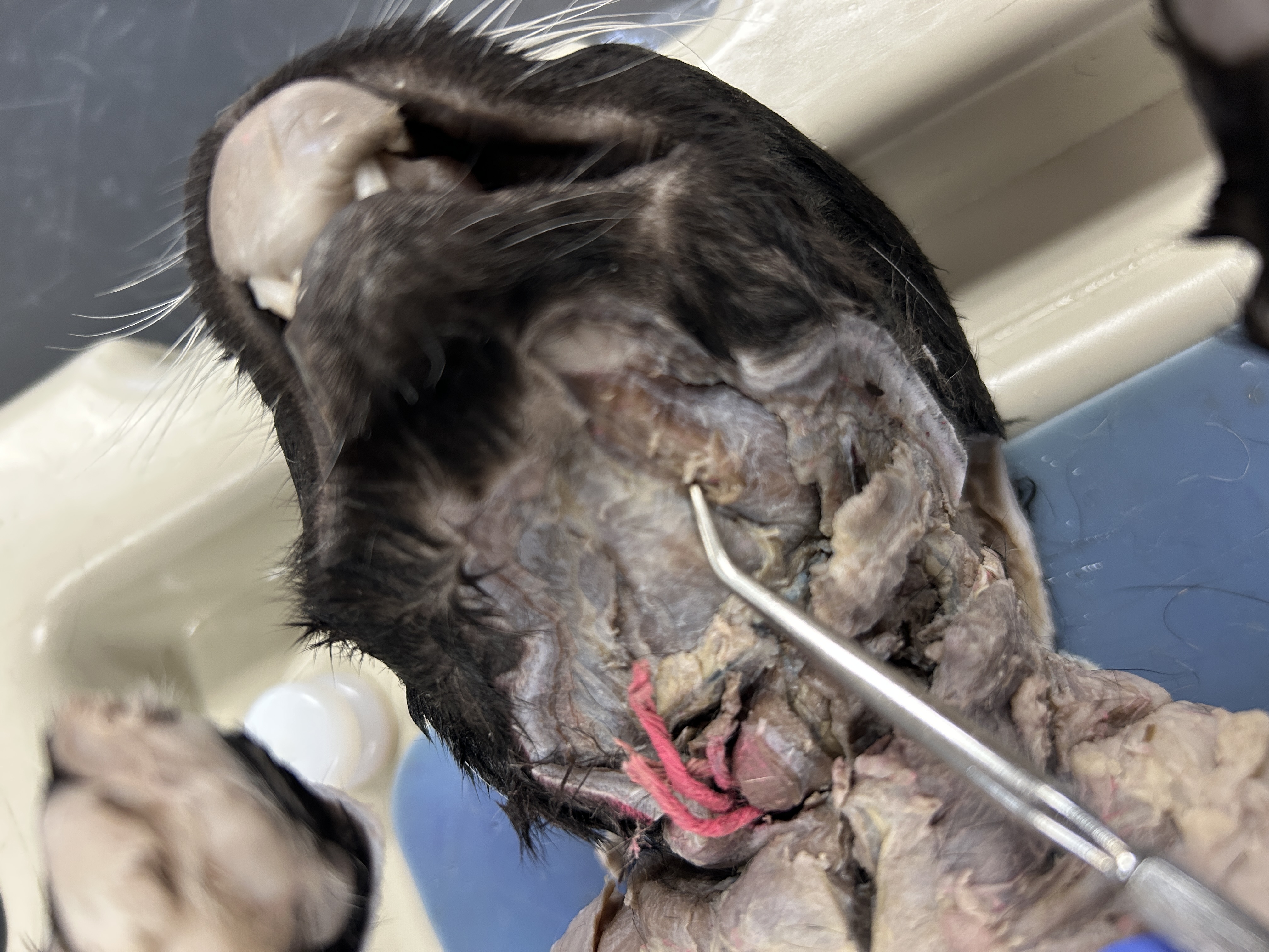 <p>Digastric (connects to bottom of chin) </p>